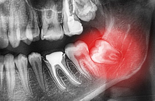 Treatment - Summerfielddental