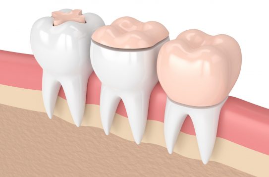 Treatment - Summerfielddental